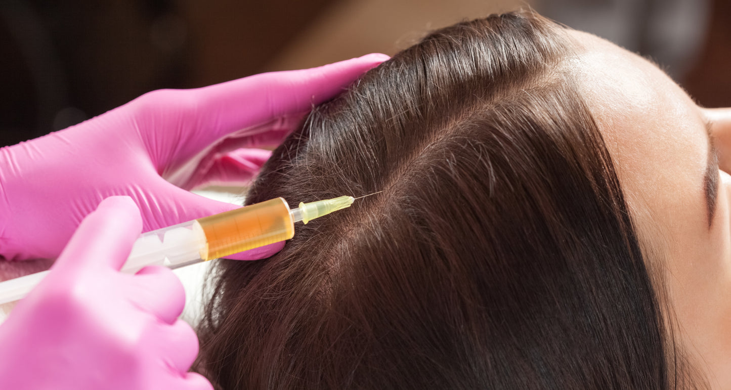 PRP For Hair Loss With / Without Microneedling